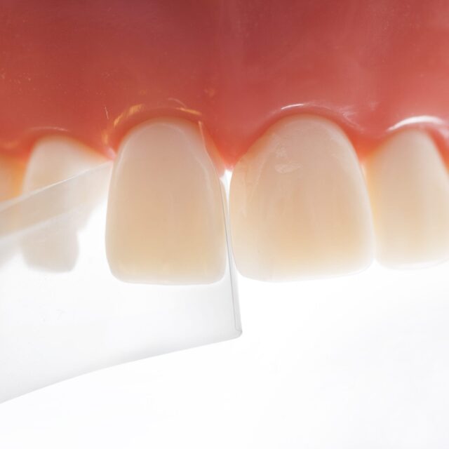 ProxyPal with teeth-2_start image