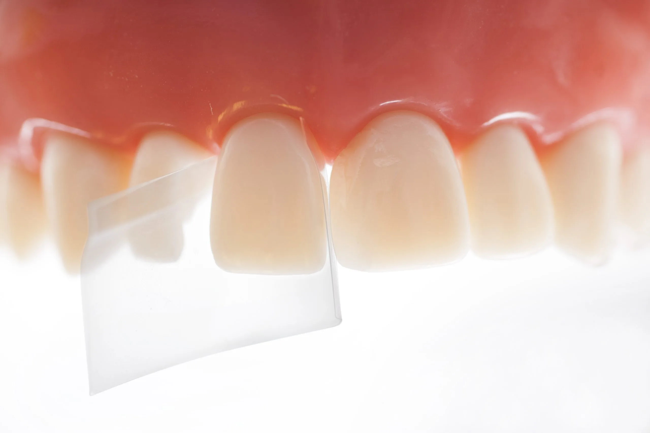 ProxyPal with teeth-2_start image