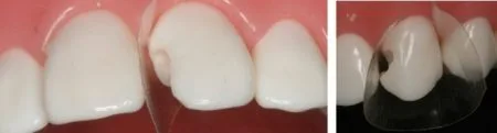 ProxyPal Clinical Cases Image 1