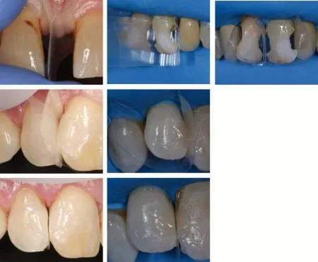 ProxyPal Clinical Cases Image 2
