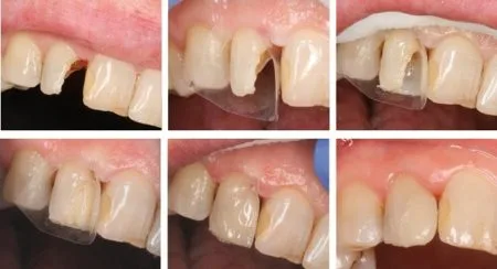 ProxyPal Clinical Cases Image 3