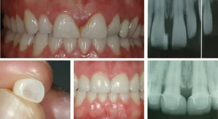 ProxyPal Clinical Cases Image 6