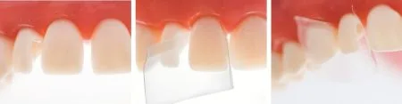 ProxyPal Clinical Cases Image 1