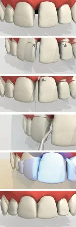 ProxyPal Clinical Tips Image 2
